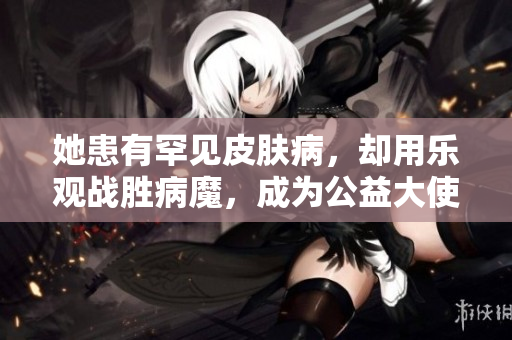 她患有罕见皮肤病，却用乐观战胜病魔，成为公益大使